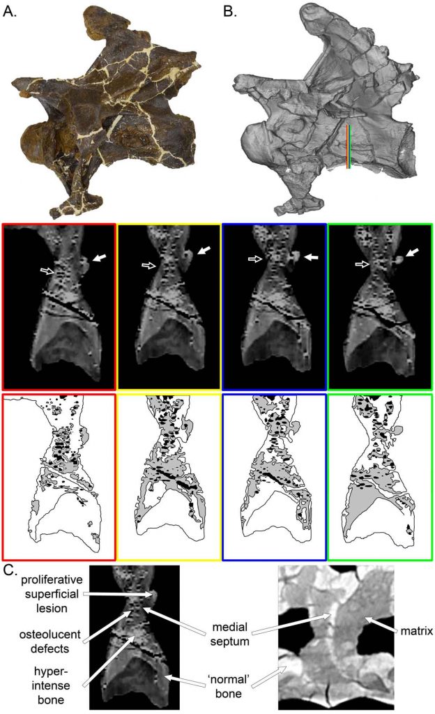 CT scans of infected vertebra from Dolly. Photograph and scan model of the infected vertebra